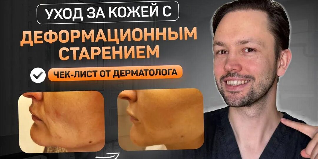 Уход при деформационном старении