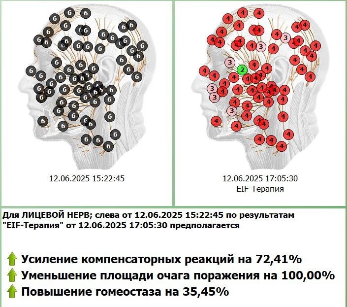 Динамика коррекции состояния в программе Дианел за 1 сеанс