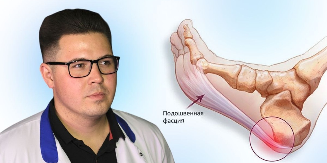Почему болит стопа: 9 причин, которые не стоит игнорировать
