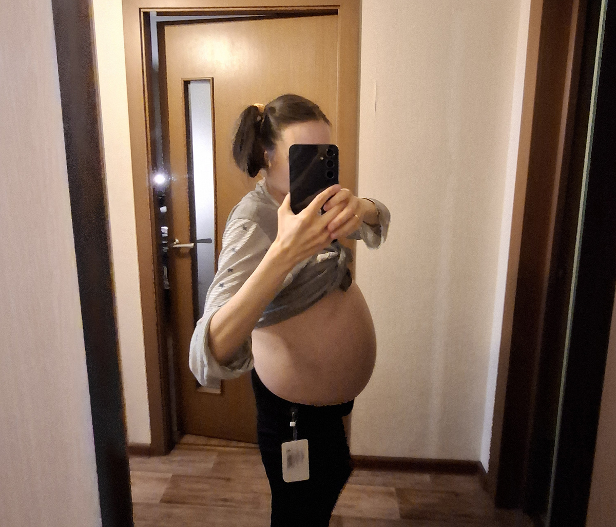 Большой живот при асците