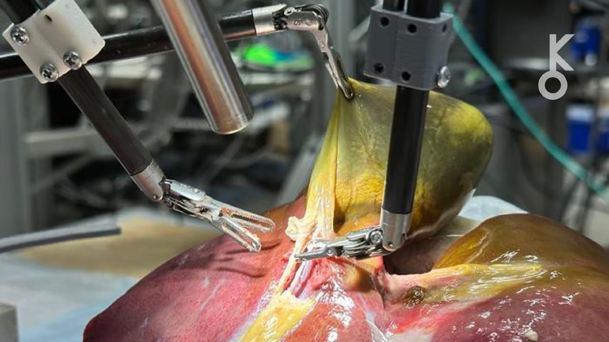 Впервые в истории робот-хирург на основе ИИ самостоятельно удалил желчный пузырь с точностью 100%, совершив восемь успешных операций на свиных моделях без прямого контроля хирурга.