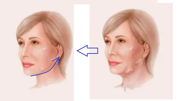 Обязательное минутное действие, которое я делаю во время умывания, чтобы овал лица всегда был четким и подтянутым