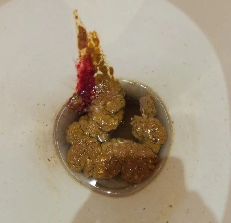 Стул 12 июля 2020