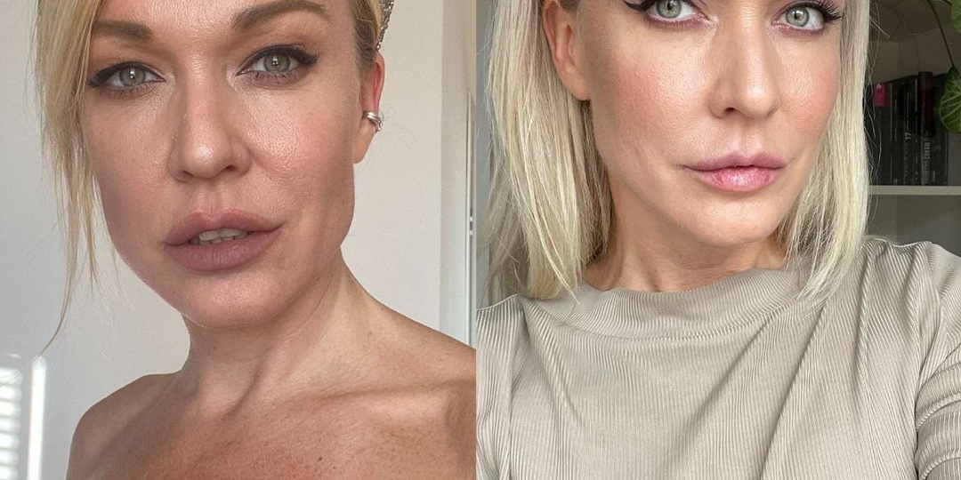 Как я с 10 раза и с подозрением на онкологию решилась на пластику в 45 лет! Часть 1. Подготовка