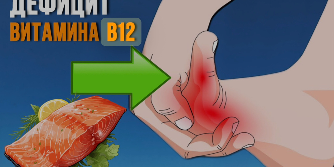 Витамин B12: 9 симптомов дефицита, которые требуют действий