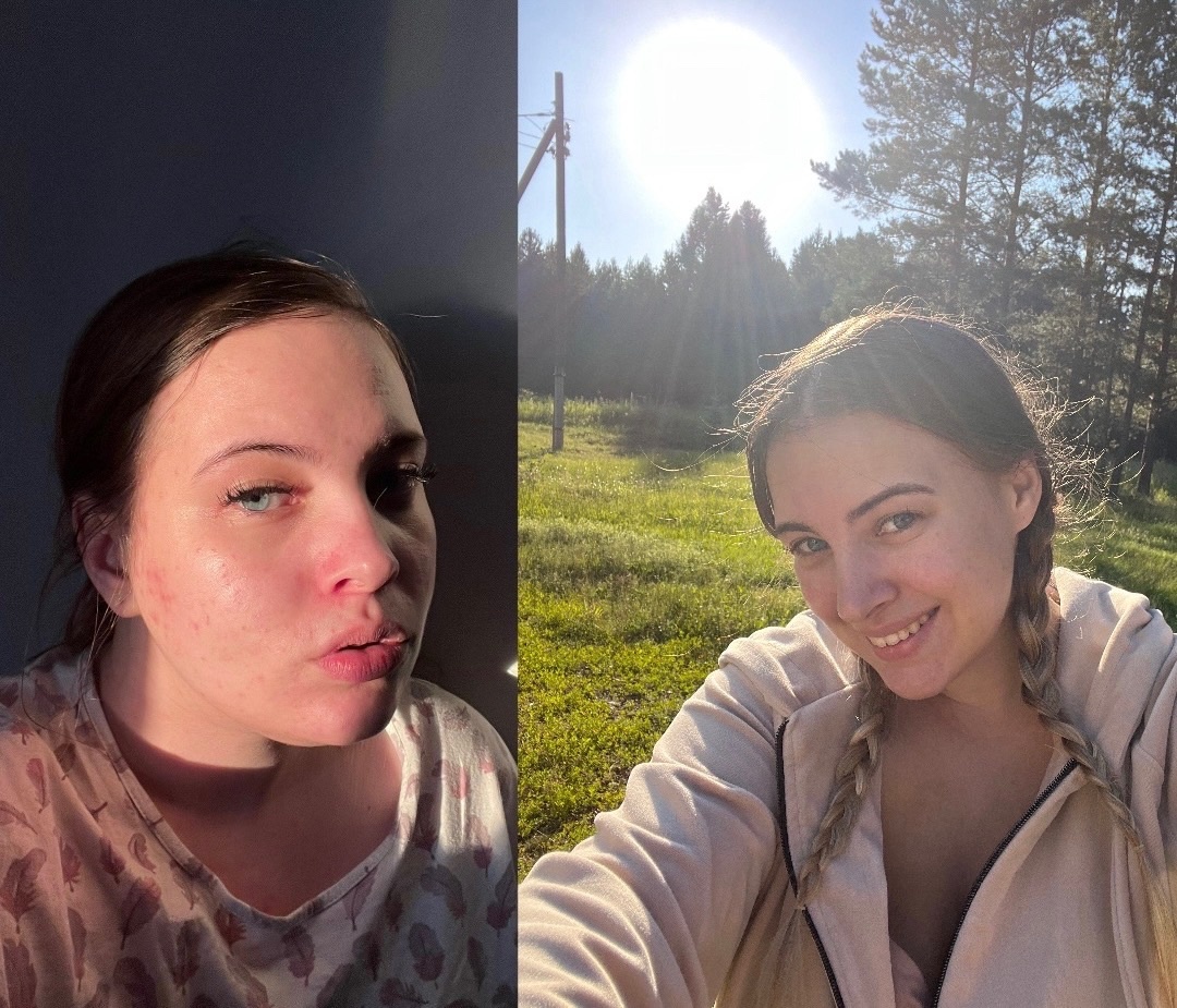 фото 2023 и 2025 года