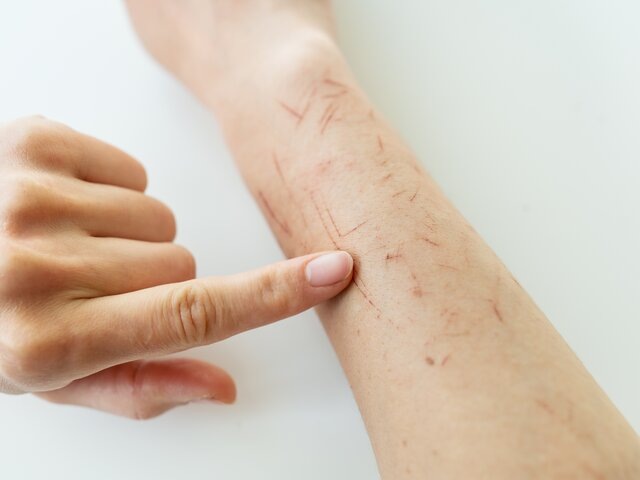    Фото: 123RF/sfinks