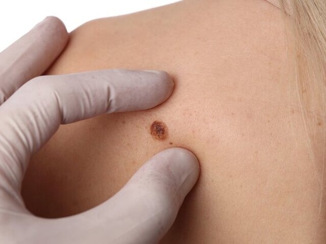    Фото: 123RF/albinaglisic