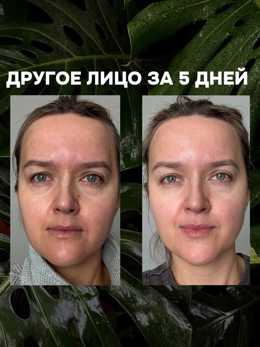 Результат всего за 5 дней 