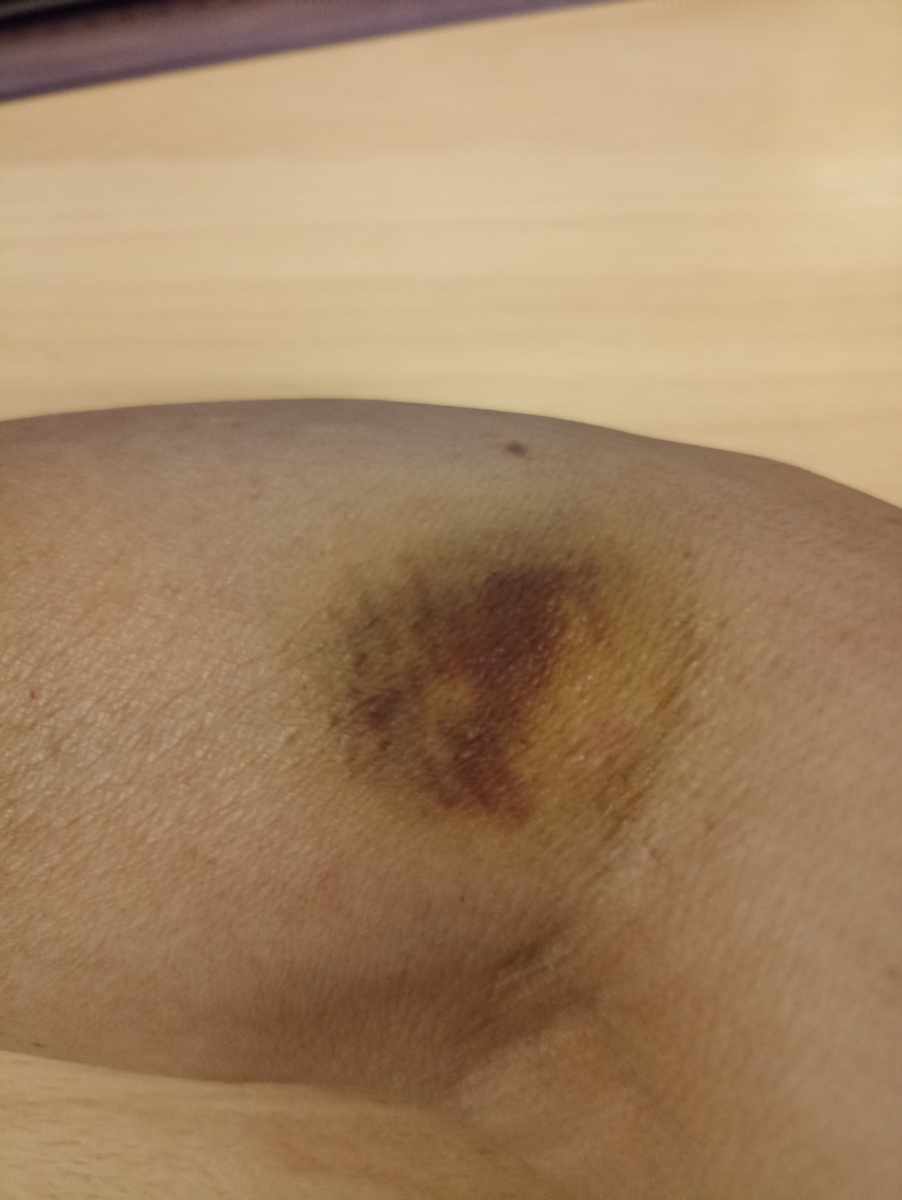 Это сделала медсестра - робот