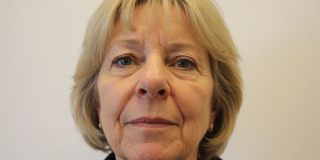 Почему нос растет после 40: 6 способов уменьшить форму носа без операции