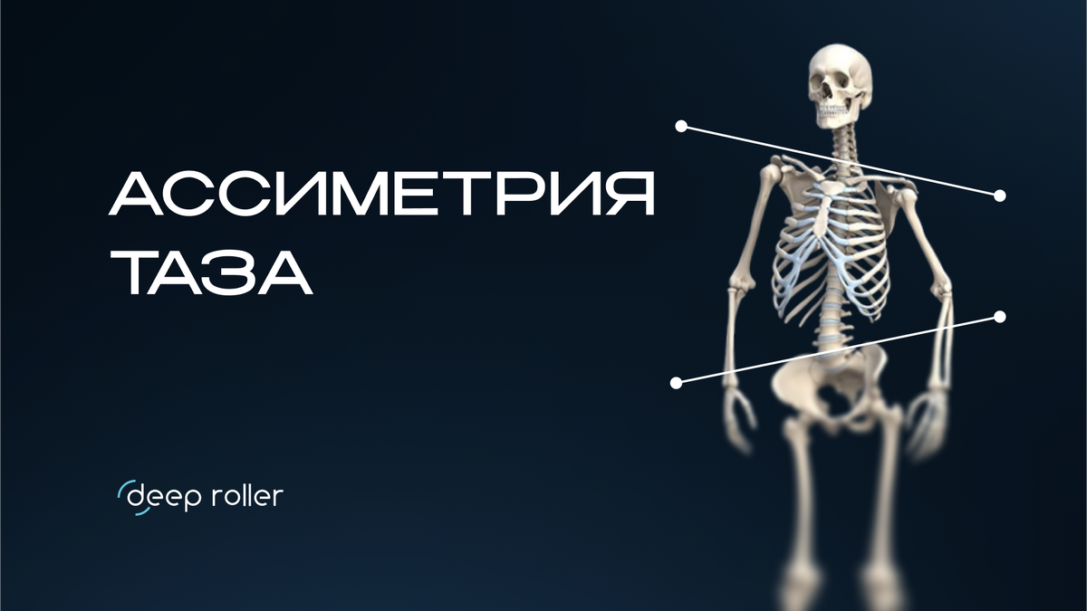 Ассиметрия таза