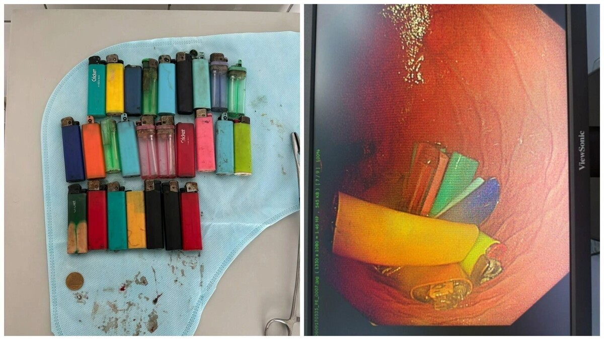     Источник: ГБУЗ РТ «Республиканская больница №1»