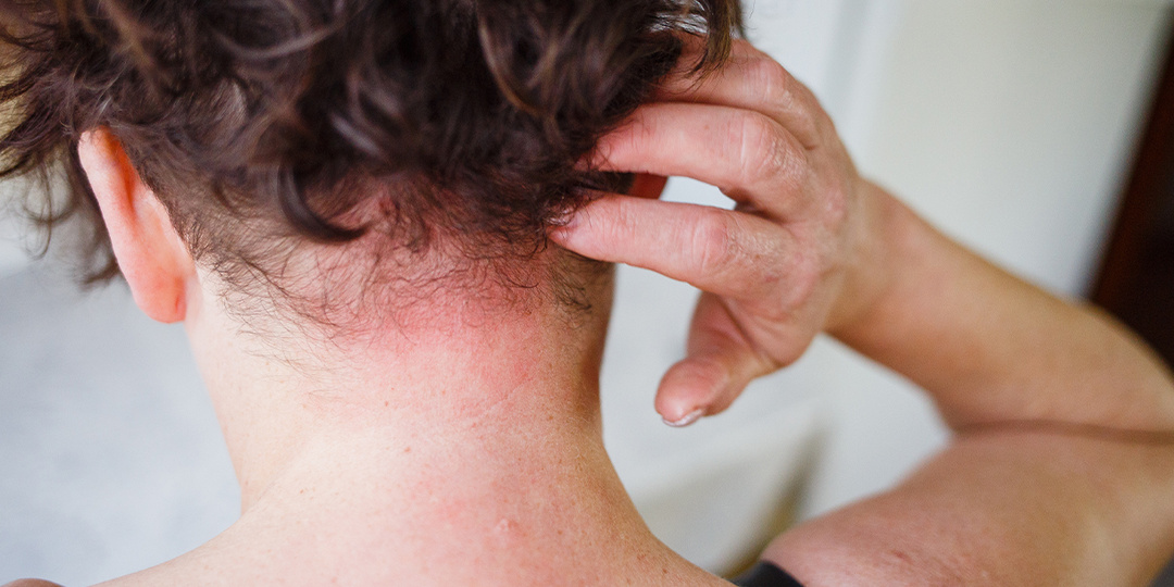 Почему нельзя игнорировать зуд кожи головы