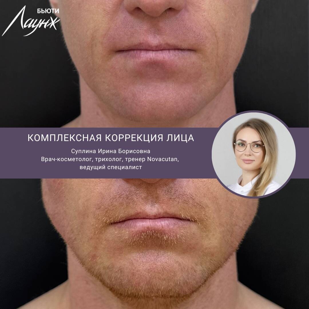 ИМЕЮТСЯ ПРОТИВОПОКАЗАНИЯ, НЕОБХОДИМА КОНСУЛЬТАЦИЯ СПЕЦИАЛИСТА