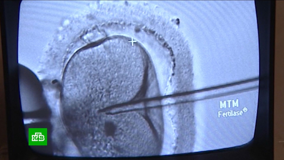    Генетические исследования для будущих родителей: в чем преимущества