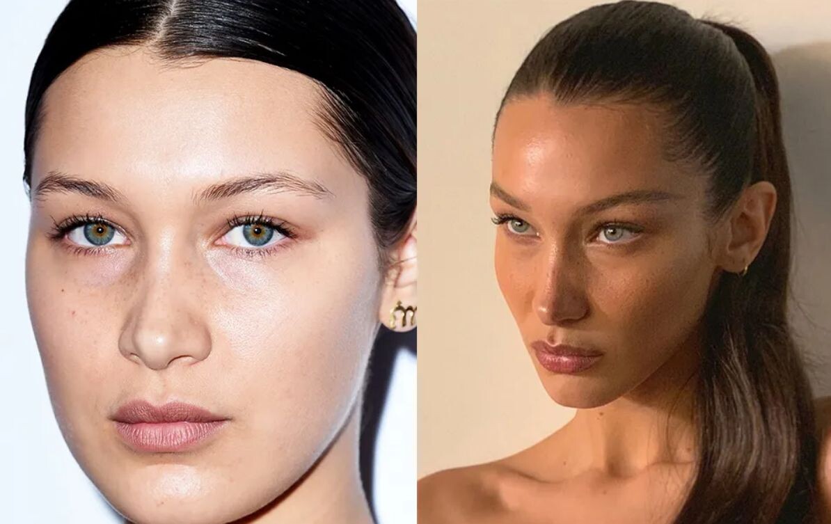 Белла Хадид до и после подтяжки