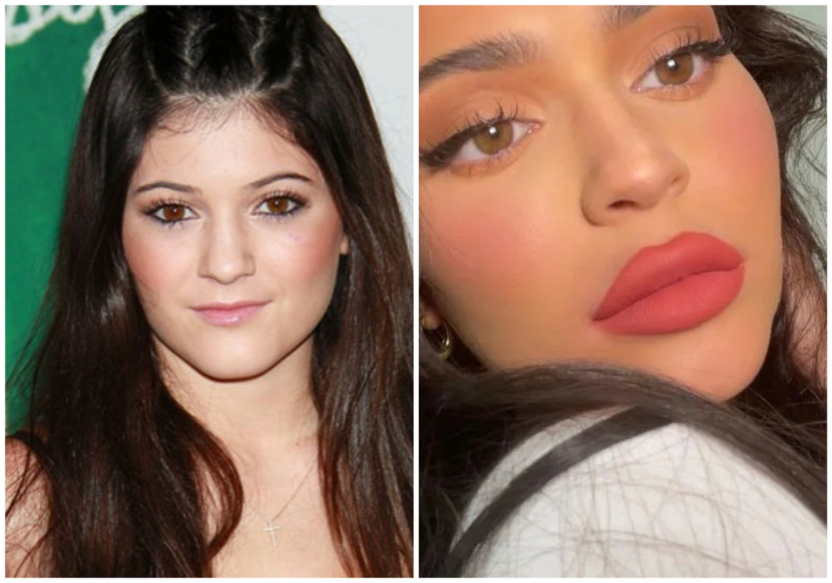 Кайли Дженнер