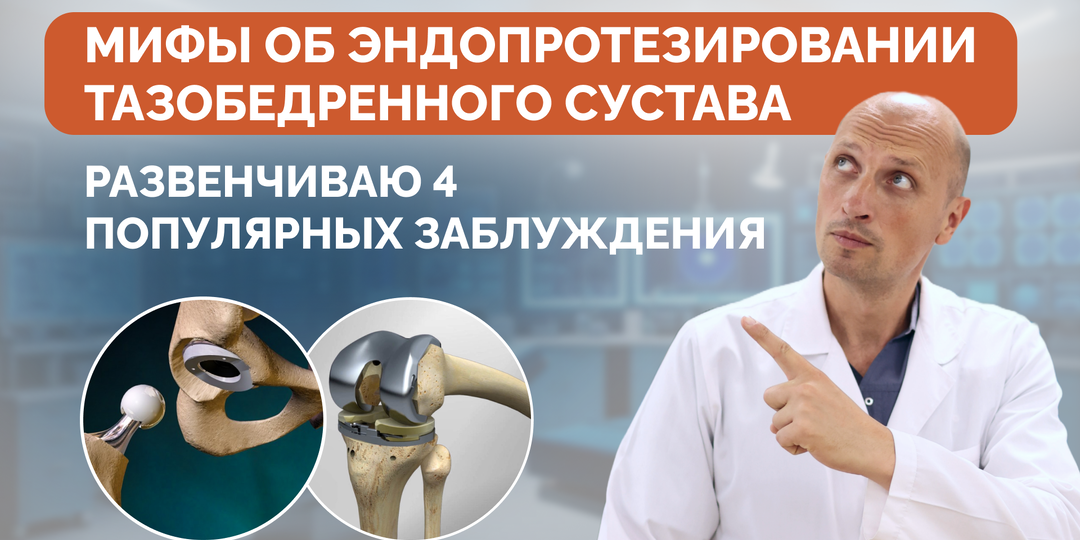 Мифы об эндопротезировании тазобедренного сустава: развенчиваю 4 популярных заблуждения