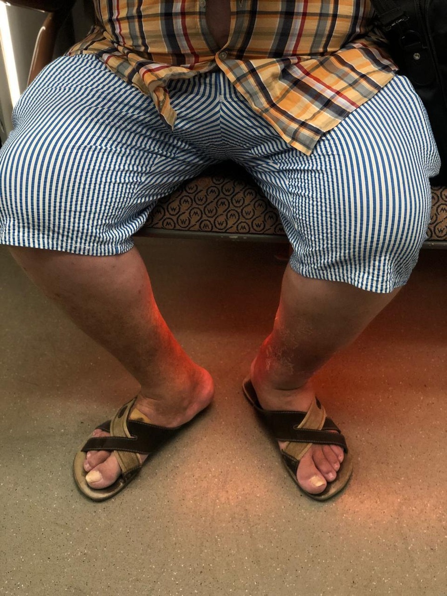 Давно назрела необходимость обсудить две вещи, которые вызывают недоумение и раздражение многих российских граждан: мужской выбор одежды и манеру сидеть, занимая много пространства.

 Мужчины в шортах в общественных местах

Почему мужчинам вдруг стало удобно появляться на улице и в публичных заведениях в шортах, словно они находятся на курорте или на отдыхе возле бассейна? Если раньше такая форма одежды воспринималась исключительно пляжным вариантом, то теперь её можно увидеть повсеместно: в транспорте, магазинах, театрах и ресторанах. Это действительно выглядит неуместно и нарушает сложившиеся нормы культурного поведения. Уважающий себя и окружающих мужчина обязан соблюдать общепринятые правила внешнего вида.

Раздвинутые ноги в общественном пространстве

Ещё одна распространённая ситуация — мужчины, сидящие широко расставив ноги, будто бы демонстрируя свою свободу действий и право занимать больше места. Однако подобное поведение мешает другим людям свободно передвигаться и создаёт дискомфорт. Понимание границ личного пространства должно стать неотъемлемой частью воспитания каждого гражданина страны.

 Куда исчезли моральные устои и воспитанность?

Мы часто слышим фразу «мы русские, значит культурные», однако поступки некоторых представителей общества ставят это утверждение под сомнение. Где остались прежние представления о вежливости, уважении и внимании друг к другу? Вернём ли мы обратно чувство собственного достоинства и осознанность поведения?

Давайте помнить, что уважение начинается с самого себя и проявляется в каждом поступке. Каждый гражданин ответственен за создание комфортной среды вокруг себя. Только совместными усилиями сможем вернуть обществу утраченную гармонию и уважение традиций. 

#Традиции #Уважение #Воспитанность #Общество #культура #одежда #этикет  #Россия