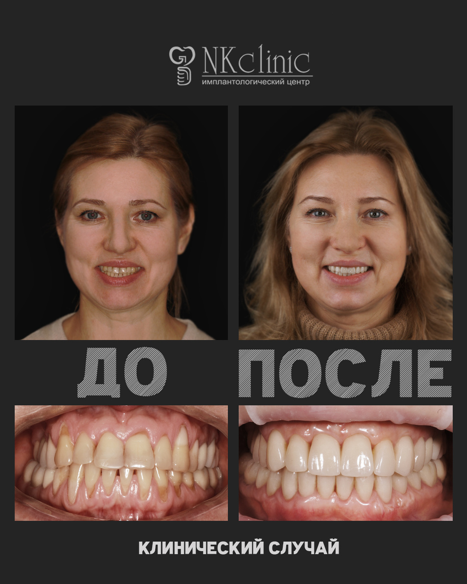 Листайте карусель