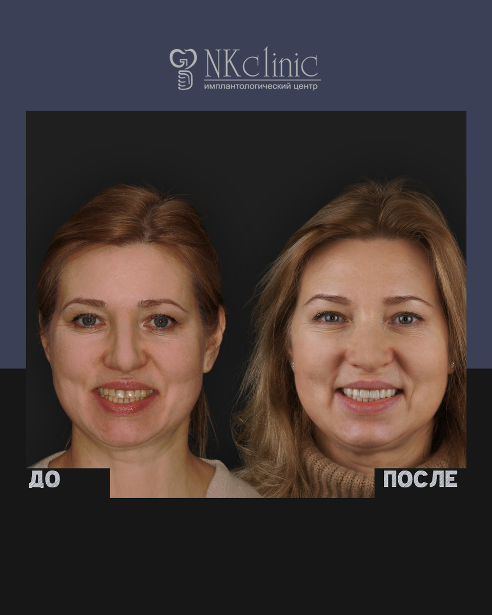 Листайте карусель