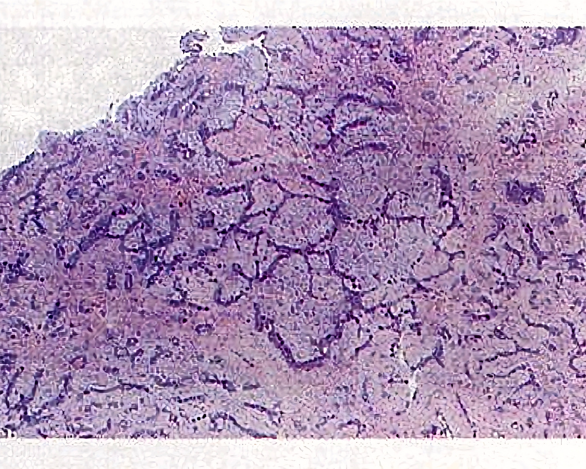 Под микроскопом