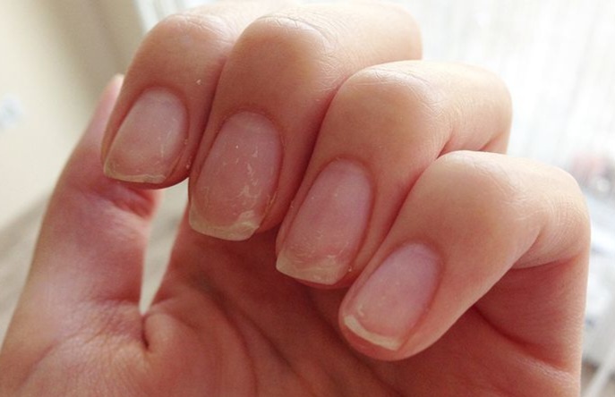 Ногти после очередного снятия