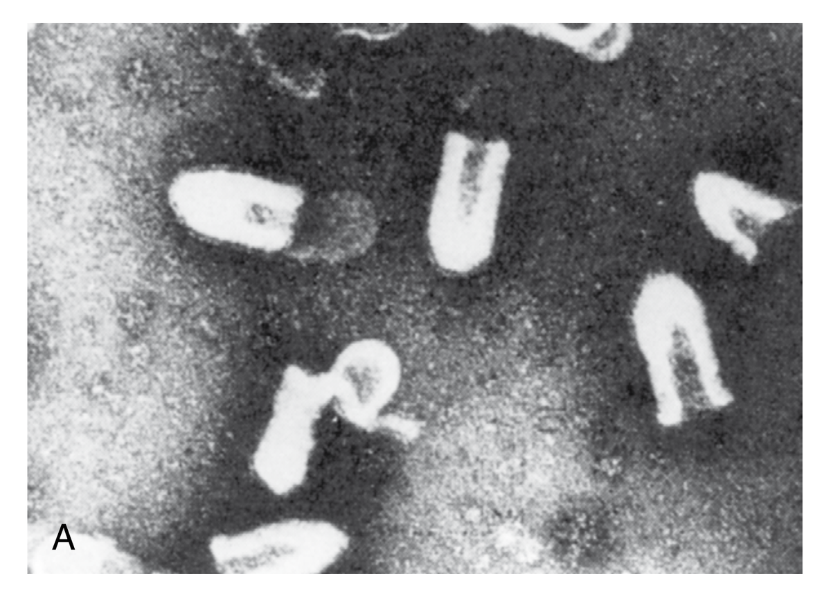 Вирионы вируса бешенства под электронным микроскопом. Изображение из Mandell, Douglas and Bennett's. Principle and Practice of Infectious Diseases, 7th ed.