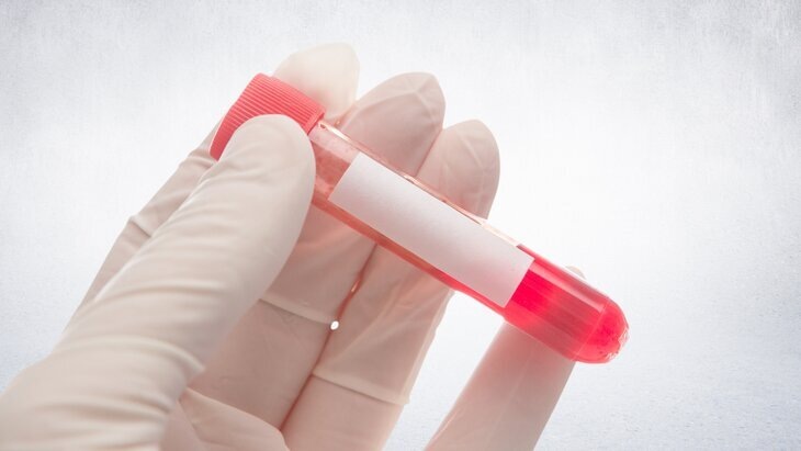    Фото: 123RF/vectorfusionart