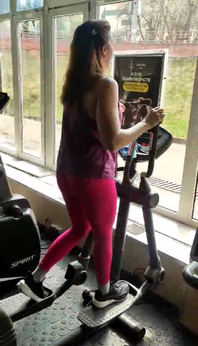 Одна из моих пациенток спустя несколько месяцев после операции на стопу на эллипсе 