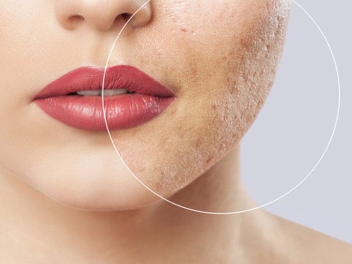 Секреты вечной молодости раскрыты! Минус 10 лет за 5 минут в день! (Без ботокса и операций!)