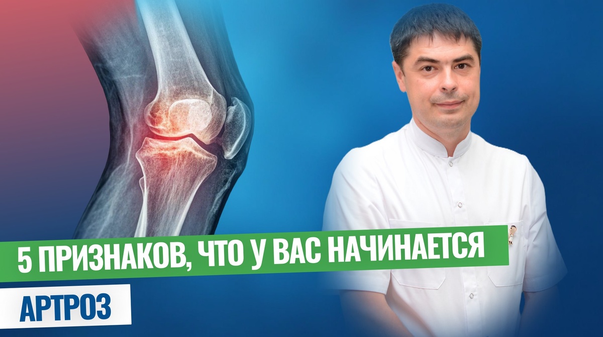 Начальная стадия артроза