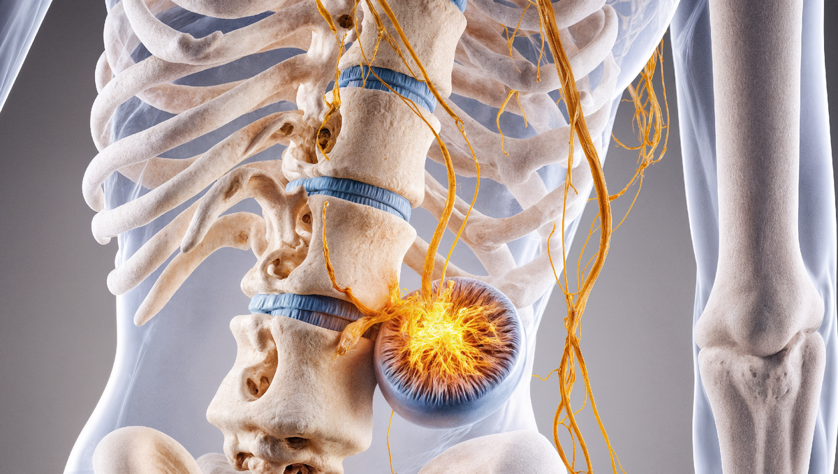 Симптомы грыжи: как распознать, лечить и убрать боль