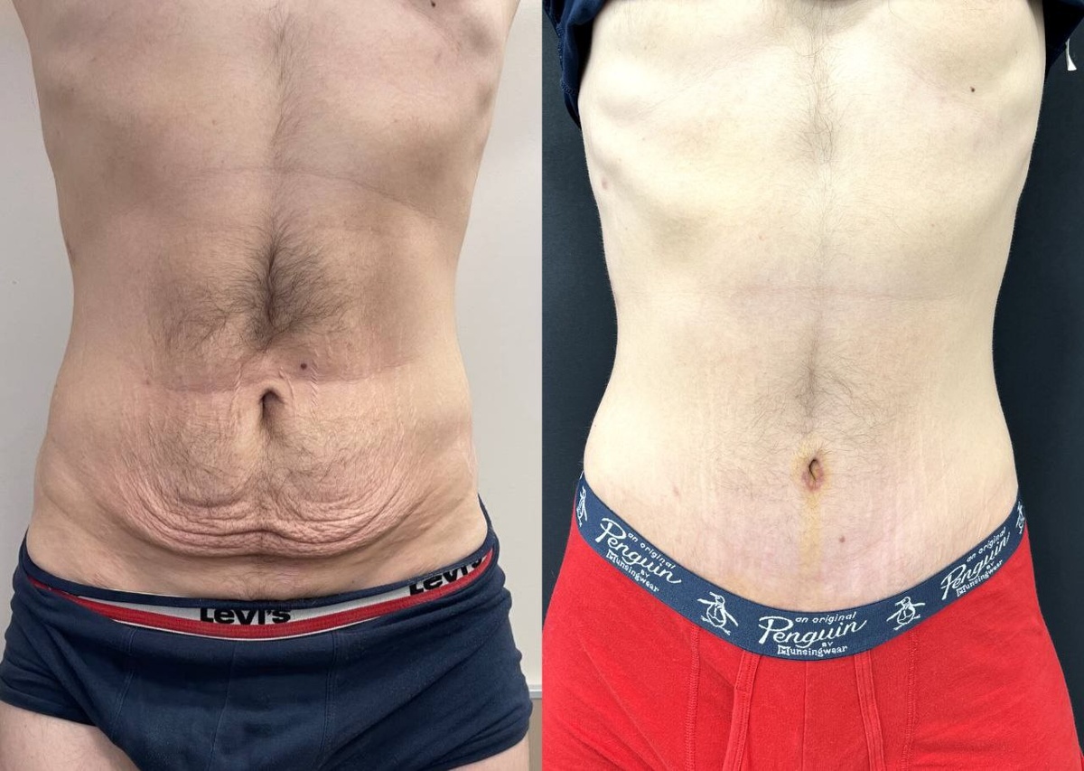 Результат работы пластического хирурга Фролова Е. В.