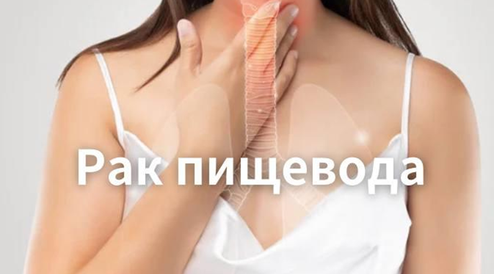 Молчаливый враг — что нужно знать о раке пищевода