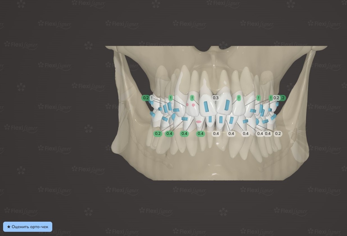 на фото она, конечно, статична, но в полноценном в файле вы сможете наводить на нее курсор и в видео формате наблюдать, как двигаются зубы.