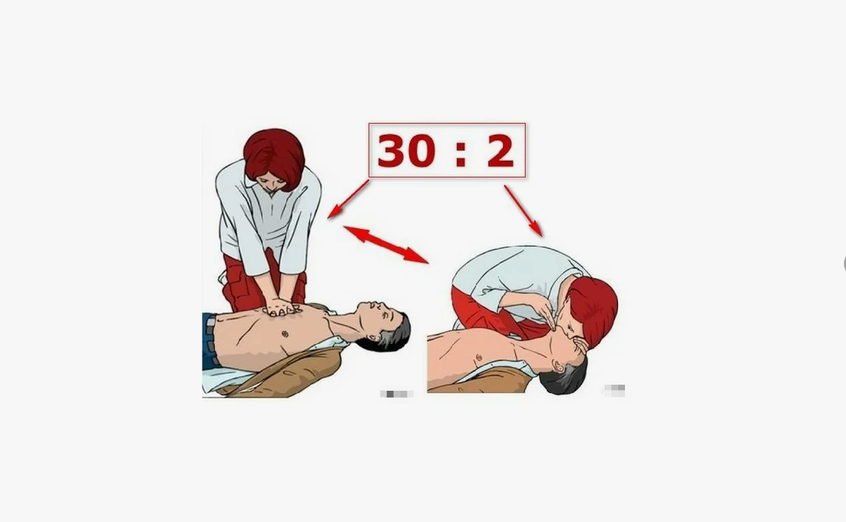 алгоритм оказания СЛР