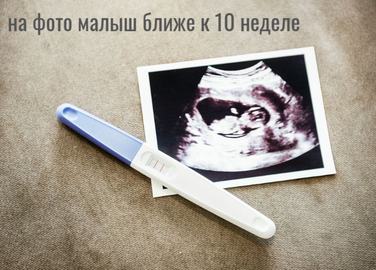 фото - разработка автора