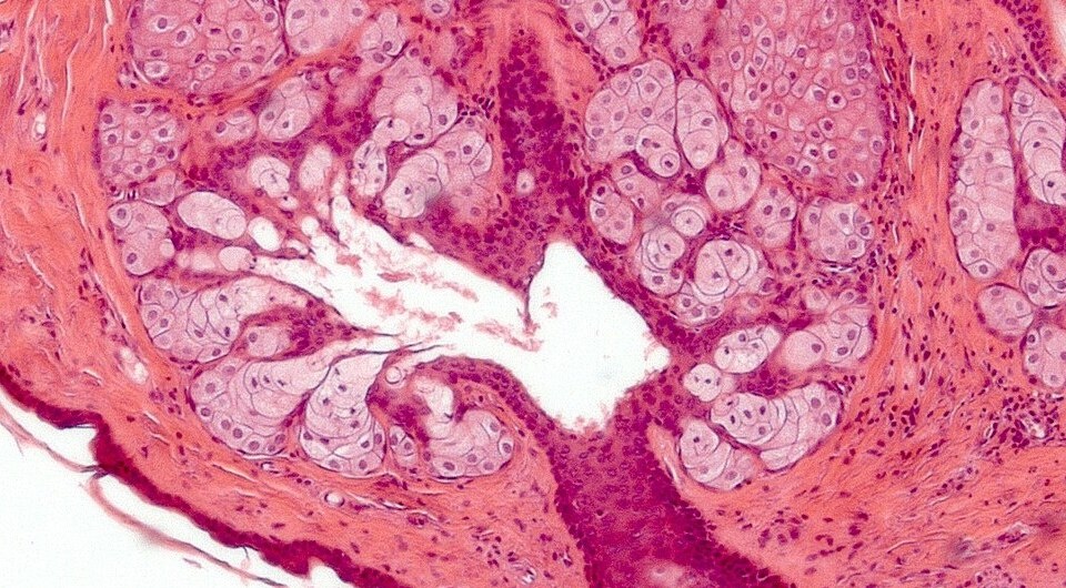   Pathologist without beard / Wikimedia Commons, CC-BY-4.0