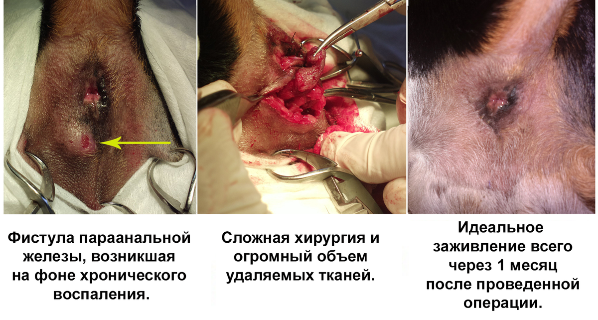 Рисунок 5. Удаление параанальных желез у 10-летнего фокстерьера. Владельцы мучились с постоянными фистулами более 7 лет (!!!) - почти всю жизнь собаки... (фото Перепечаева К.А.).