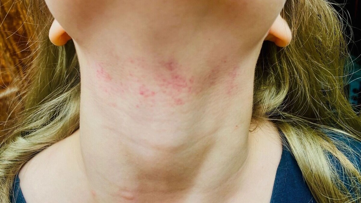     Источник: вИшиме.орг