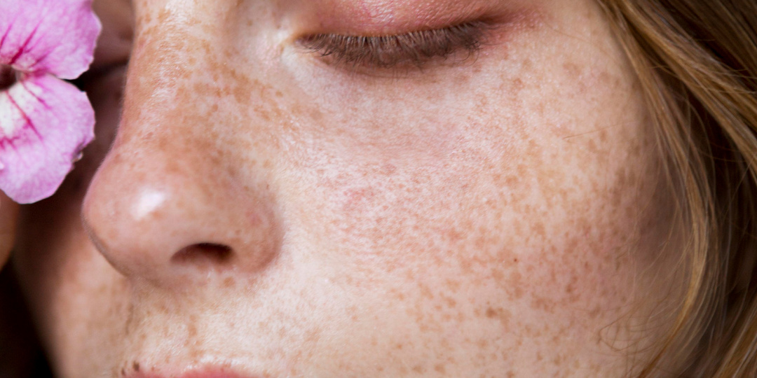 Косметика для устранения темных пятен – на какие компоненты в составе обратить внимание