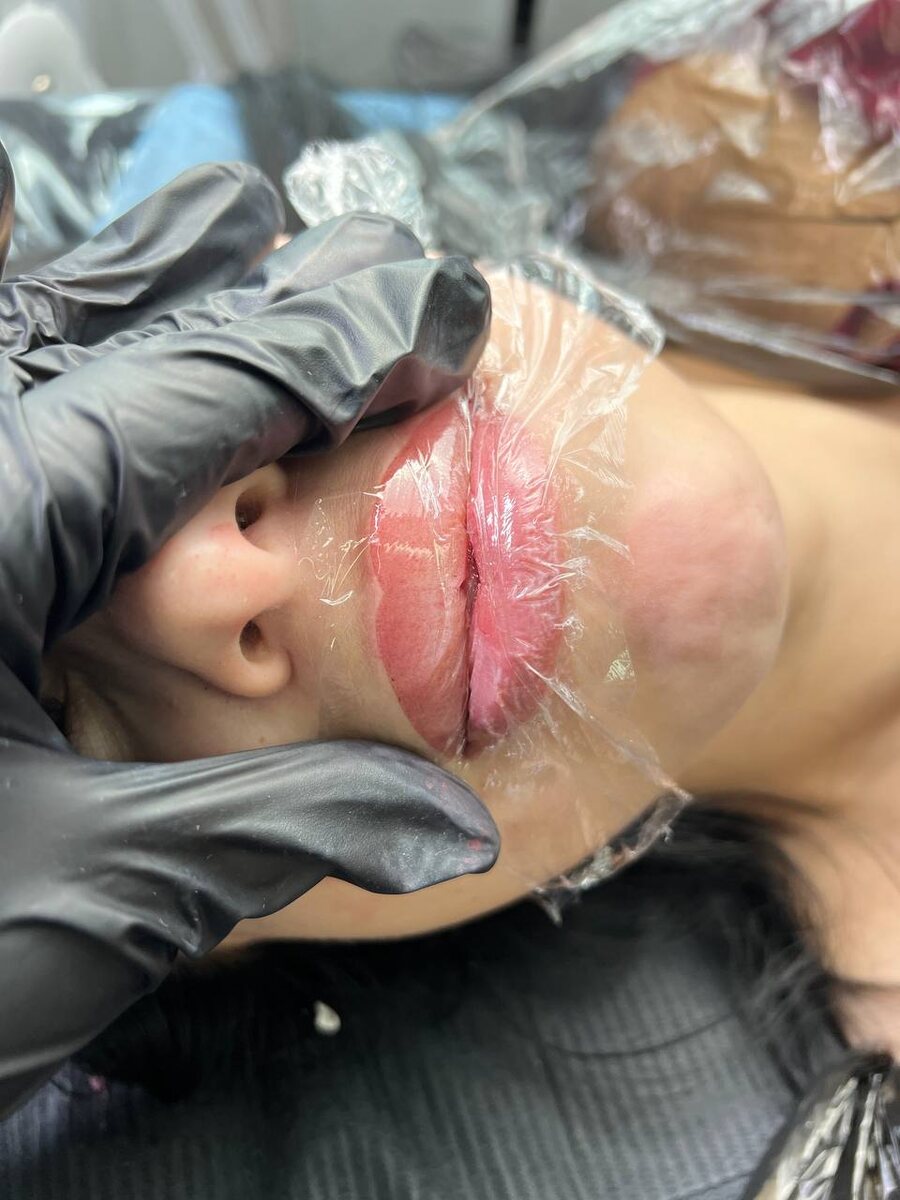 -2