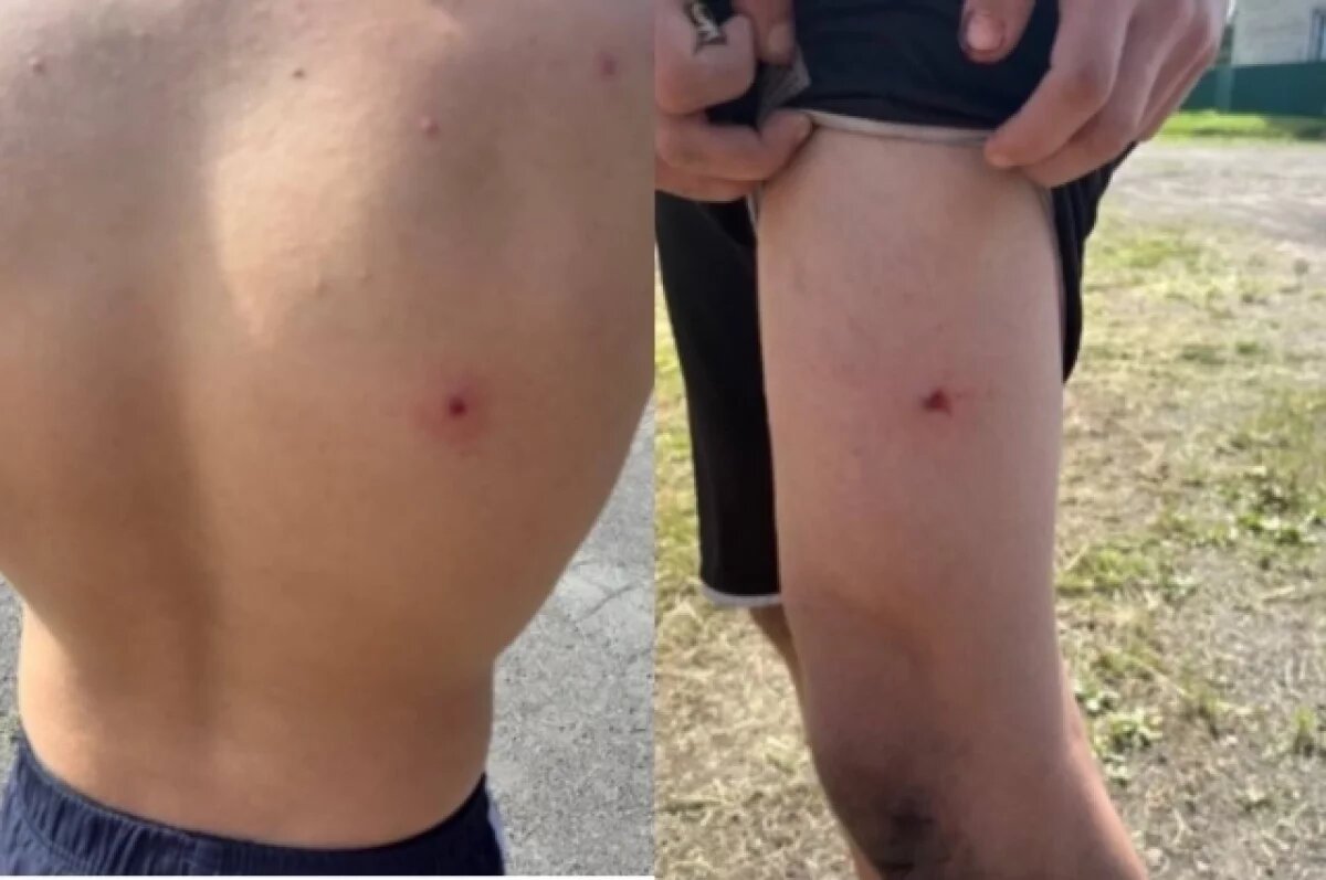    Подростки обстреливали других из пневматического пистолета.