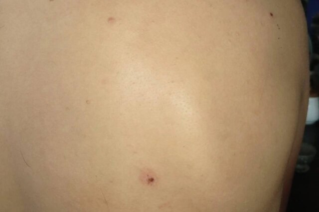    Мальчикам стреляли по ногам, в голову и в спину. Фото: Предоставлено героем публикации «АиФ-Новосибирск»