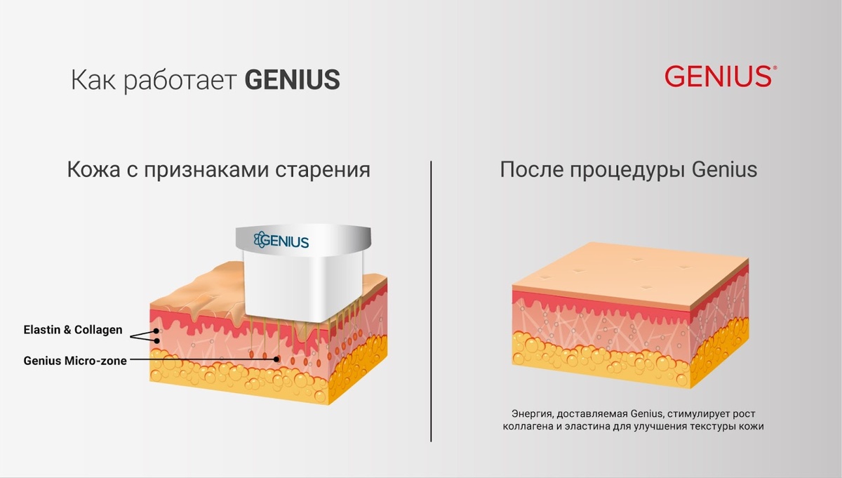 Как работает Genius?