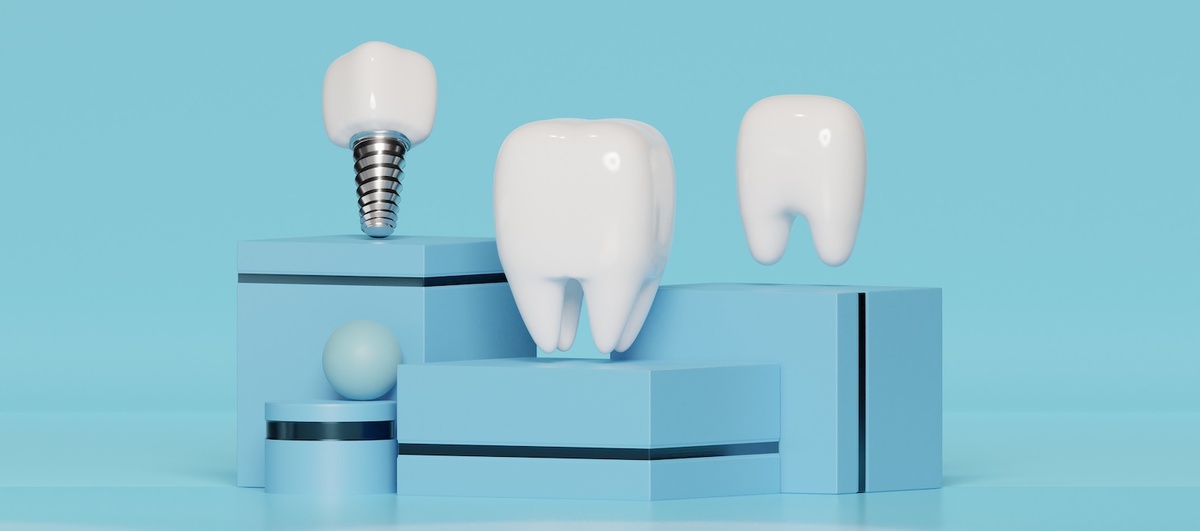 Можно ли ставить импланты в пожилом возрасте?