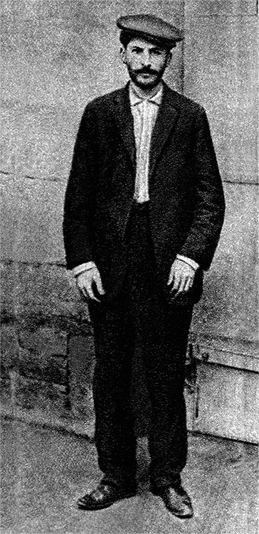 Джугашвили И.В. Левая рука слегко согнута и складывается впечатление, что она короче.