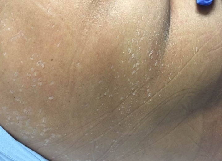 Кристаллическая потница